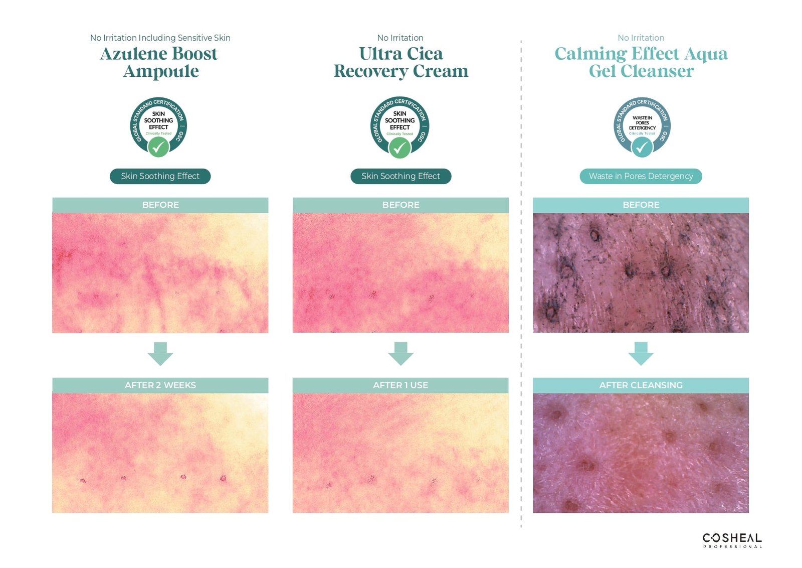 Crema calmanta cu Centella Asiatica pentru pielea sensibila, efect antirid si de luminozitate, Ultra Cica Recovery, Heal, Cosheal Professional, 70 g - imagine 2