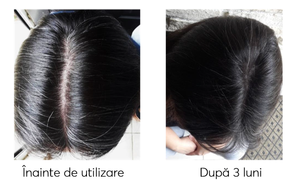 Trial kit, Travel Size tratament impotriva incaruntirii si caderii parului, Ageless Clinic, 3 bucati, Rut Hair, 80 ml - imagine 9